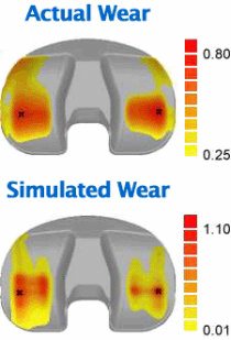 A comparison of simulated vs actual wear on knee implant
