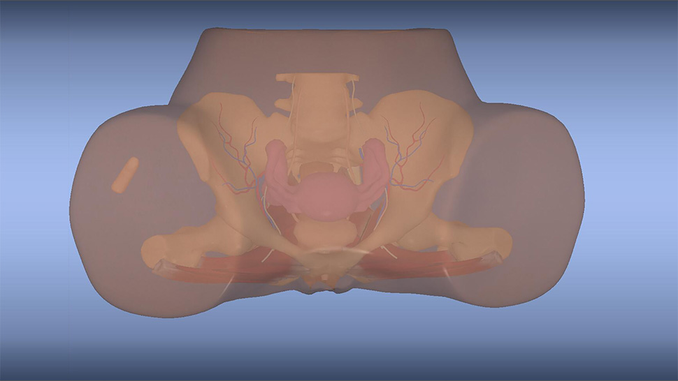 Pelvic screening