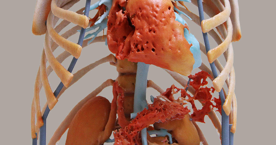 Create realistic medical 3D models - Courtesy of WhiteClouds
