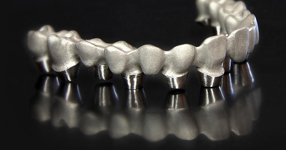 Direct Metal 3d Printing Brings Growth Benefits To Microdent Dental Lab 3d Systems